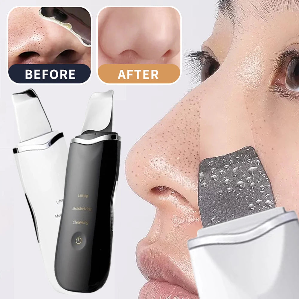 Electric Skin Scrubber Peeling Blackhead Remover Deep Face Cleaning Lifting Ion Acne Pore Cleaner Facial Spatula Shovel Cleanser