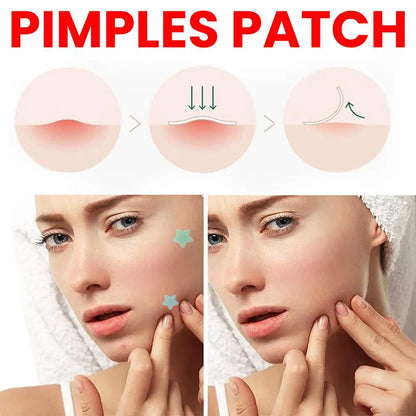 200pcs Star Shape Pimple Patches Colorful Hydrocolloid Pimple Healing Sticker Cute Strong Absorption Zit Patches Face Care