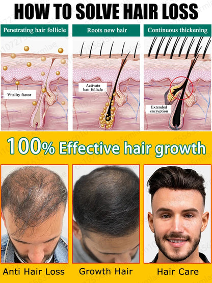 Hair growth essential oil, the latest research results, can grow hair anywhere. Repair baldness and hair loss